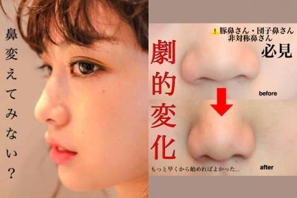 日本爆紅「縮鼻翼按摩」，蒜頭鼻日妞含淚實測：5天看見鼻樑！
