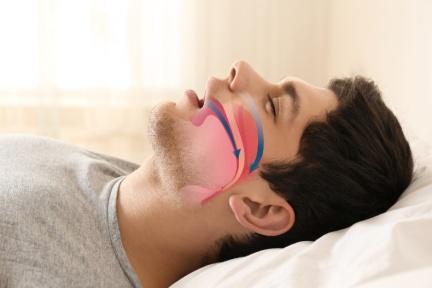 睡覺從此不打呼！耳鼻喉科醫師親授4步驟、10分鐘免開刀，實測有效的止鼾秘訣