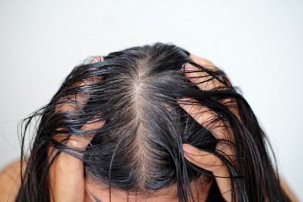 每天洗頭還是有油頭味？「日常5大NG行為」，讓你頭臭散不去