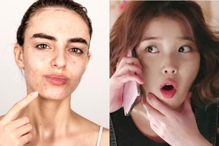 講電話導致長暗瘡？４大生活習慣恐是爛臉原因：手機貼臉、常用髮油、不換衣服