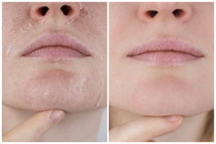 秋冬皮膚問題多？５招護膚攻略讓你換季保養不爛臉
