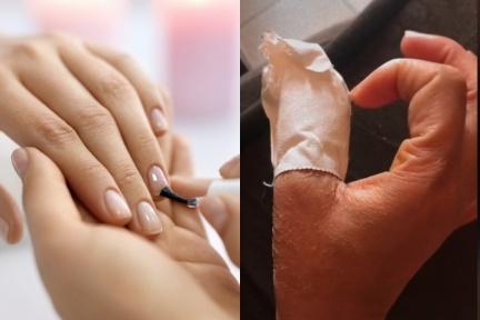 網紅愛美做指甲，拇指「發黑流膿」遭截肢！醫提醒：美甲３風險＋６注意事項
