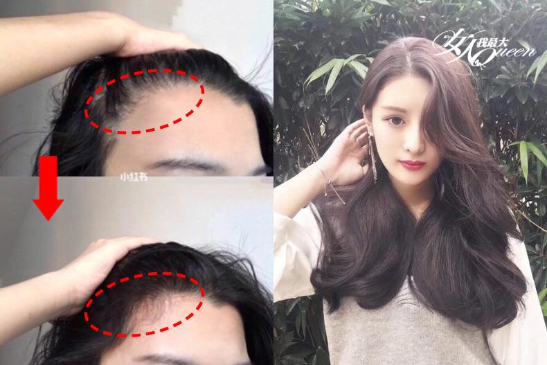 日本最新「懶人增髮按摩」！15天髮量增一倍，減齡少女感UP