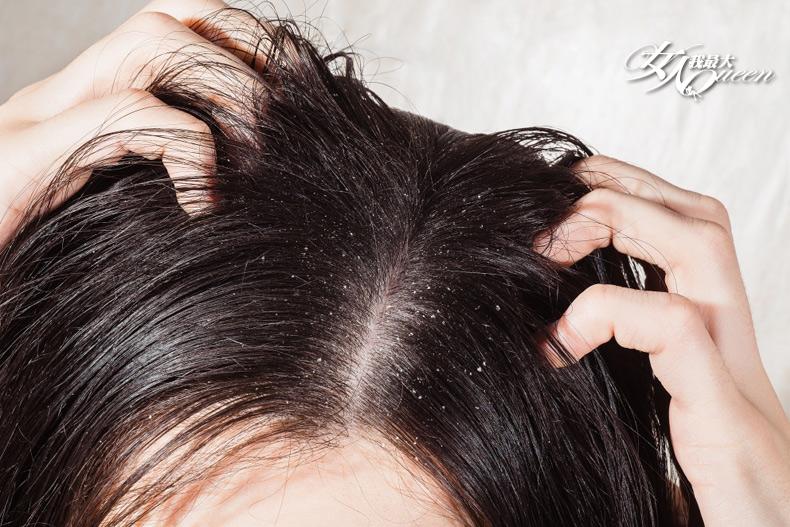 換季頭皮屑滿天飛？超強中醫養髮秘訣「5款洗頭水」原來橘子皮也能護髮