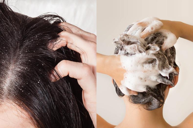 原來洗頭前要做「這事」，就能改善頭皮癢和雪花飄的大煩惱