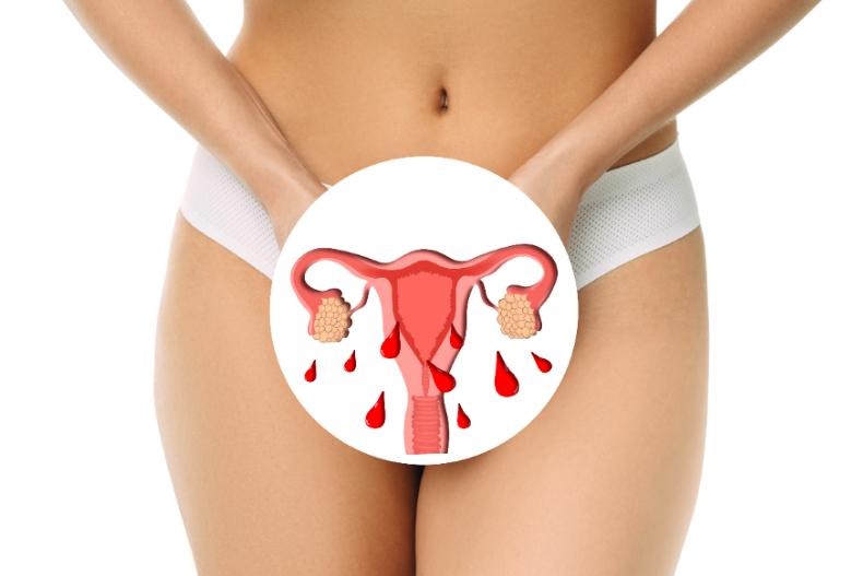 月經幾天算正常？「經期」4大重點檢測，未達標代表「子宮」健康拉警報！