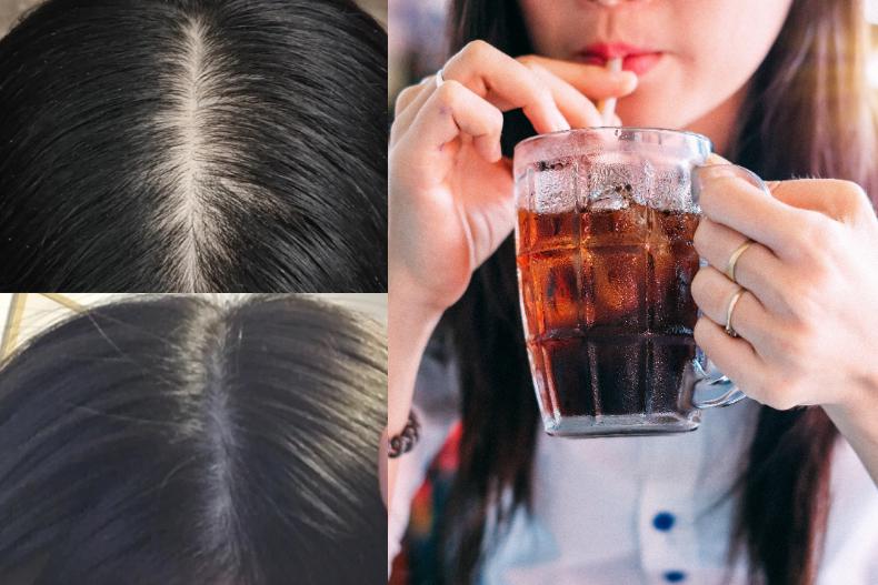 咖啡、奶茶也會傷害頭髮健康！這4大類飲料可能比酒還傷身
