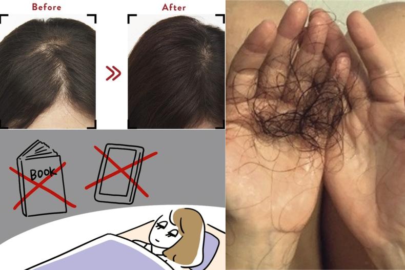 抗掉髮原來超簡單！日頭髮診斷師親授4習慣找回健康頭皮：X點後別攝取咖啡因