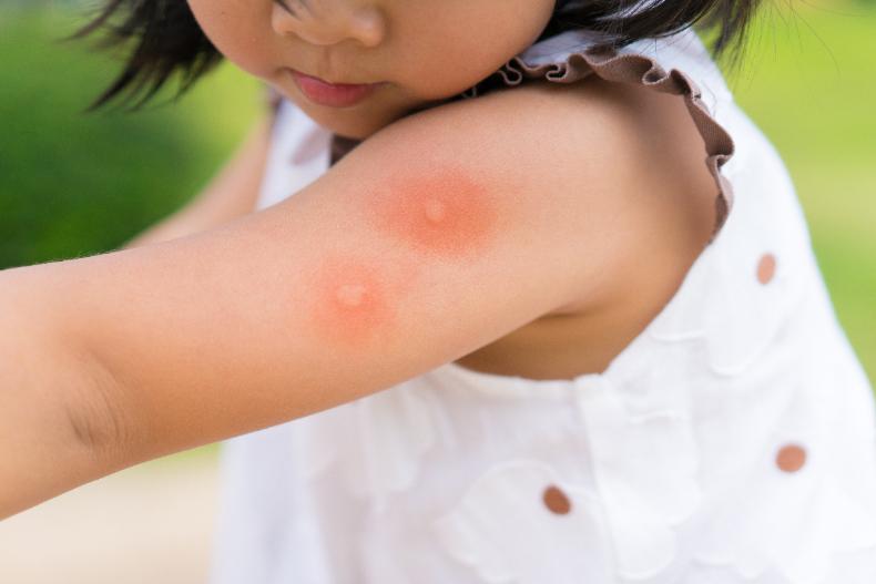 夏天防蚊有妙招！日本專家傳授３招防蚊咬，水盆裡放「這個」還能避免蚊蟲孳生