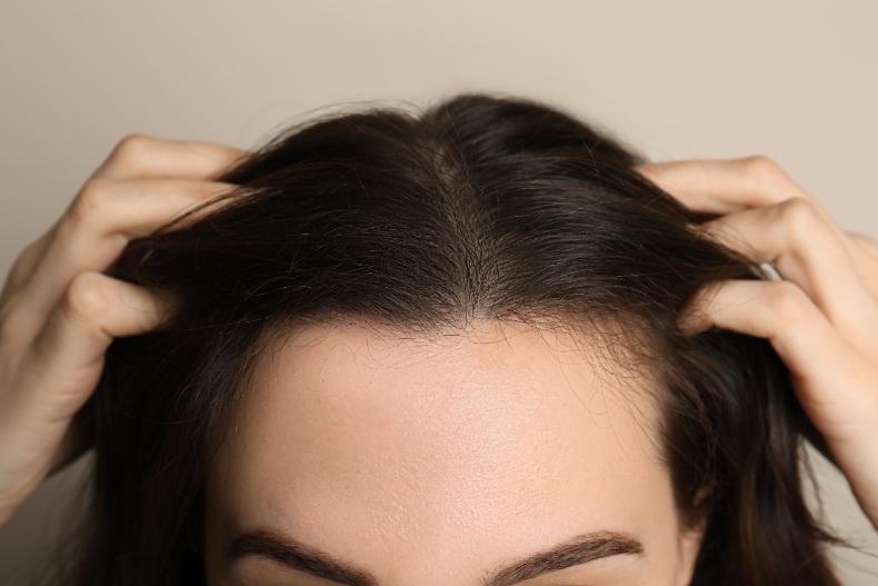 髮粉會傷害頭皮嗎？盤點髮際線粉優缺點、副作用、注意事項，使用不當恐掉更多頭髮
